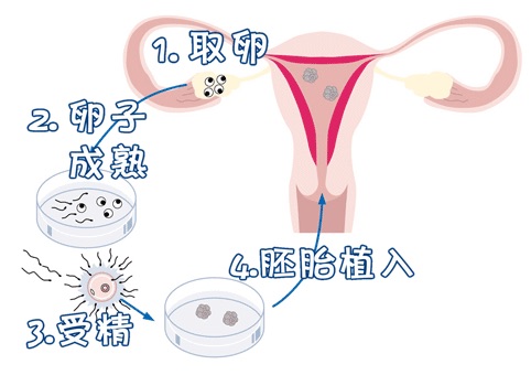 捐卵联系方式